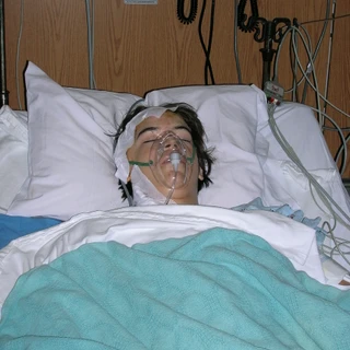 Alex in the hospital after surgery with oxygen mask