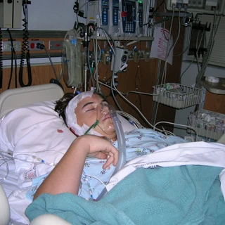 Alex in the hospital after surgery with oxygen mask (2)
