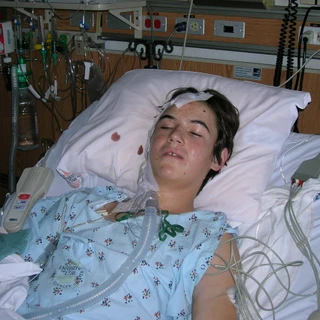 Alex in the hospital after surgery awake with bandages