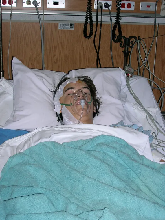 Alex in the hospital after surgery with oxygen mask
