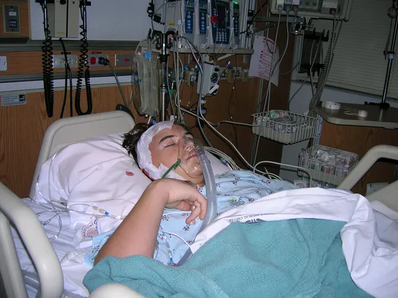 Alex in the hospital after surgery with oxygen mask (2)