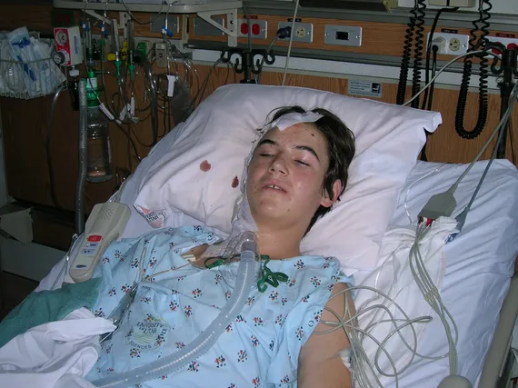 Alex in the hospital after surgery awake with bandages