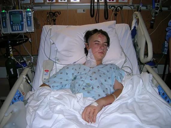 Alex in the hospital after surgery awake with bandage on head removed