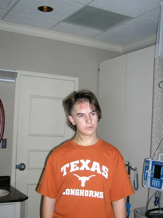 Alex in his Texas shirt at the hospital
